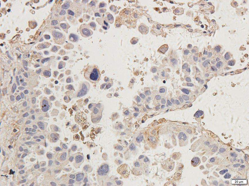 CTLA4 Rabbit Polyclonal Antibody