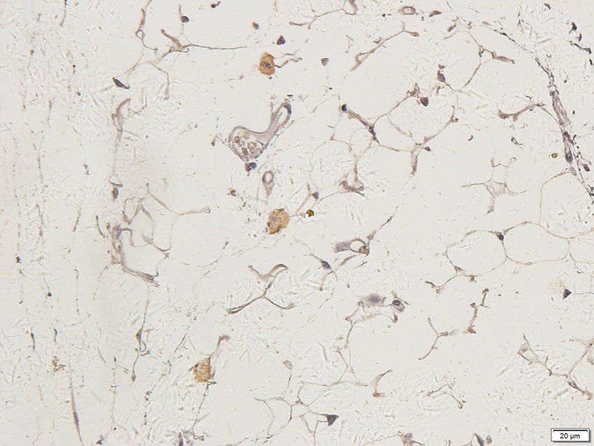 CTLA4 Rabbit Polyclonal Antibody