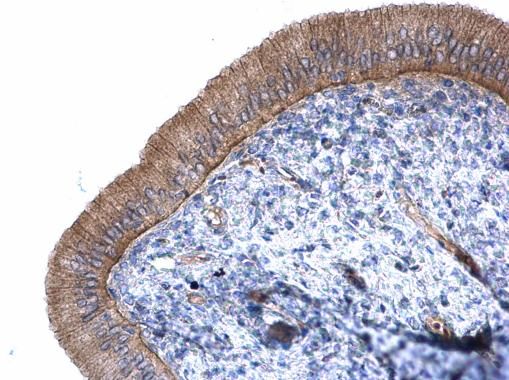 catenin alpha like 1 Antibody