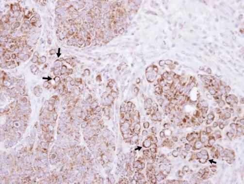 catenin alpha like 1 Antibody