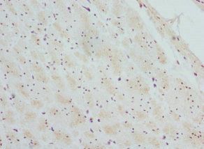 CTNNBL1 Antibody