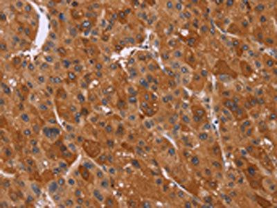 CTNNBL1 Antibody