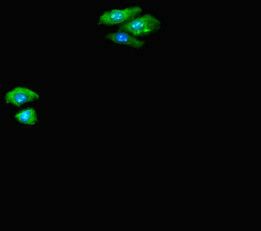 CTNND2 Antibody