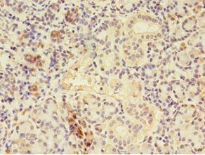 CTPS1 Antibody