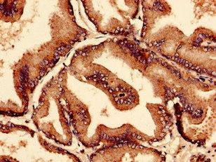 CTPS2 Antibody