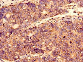 CTPS2 Antibody