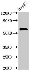 CTPS2 Antibody