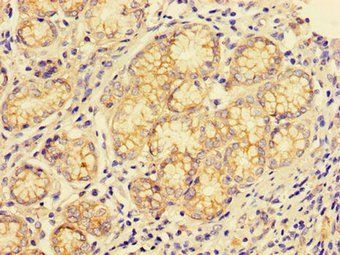 CTSE Antibody