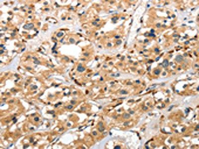 CTSE Antibody