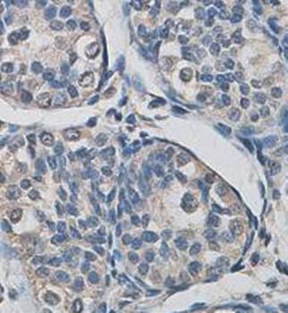 CUL5 Rabbit Polyclonal Antibody