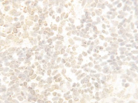 Cullin 4B/CUL4B Rabbit Polyclonal Antibody