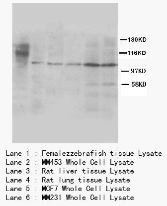 Cullin 4B/CUL4B Rabbit Polyclonal Antibody