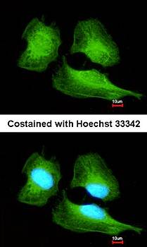 Cullin-7 antibody