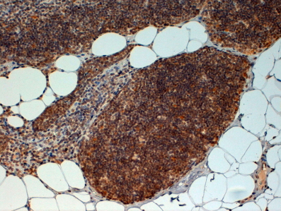 Goat anti-FOXN1 Antibody