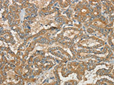 CWC27 Antibody