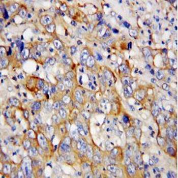 Platelet factor 4 PF4 Rabbit Polyclonal Antibody