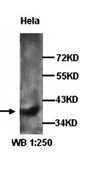 CXCR4 Rabbit Polyclonal Antibody