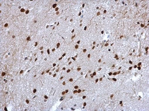 cyclin T2 Antibody