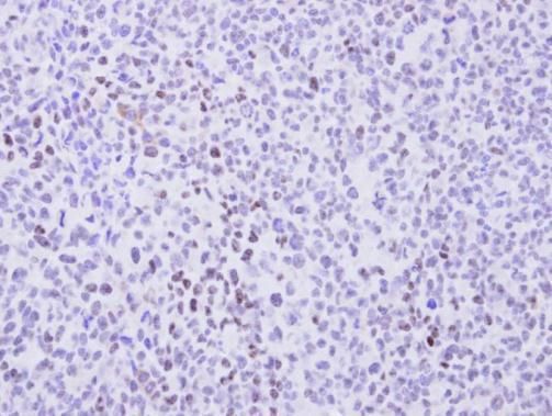 cyclin T2 Antibody
