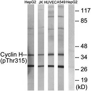 Cyclin H (Phospho-Thr315) Antibody