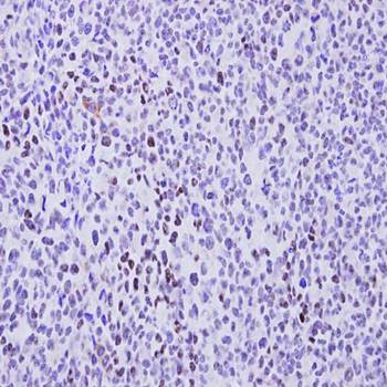 cyclin T2 antibody