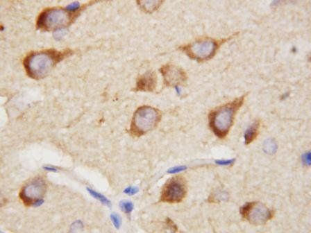 PPID Rabbit Polyclonal Antibody
