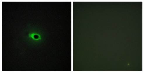 Collagen XII α1 Antibody