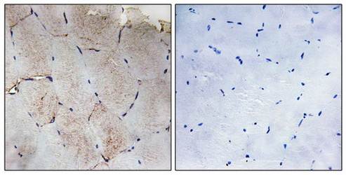 Collagen XII α1 Antibody