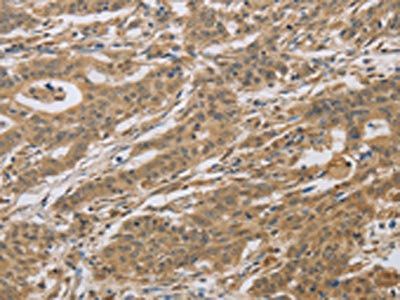 CYFIP2 Antibody
