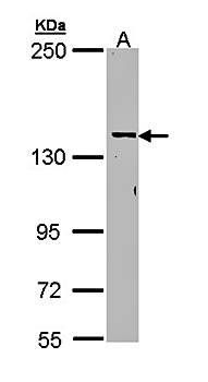 CYFIP2 antibody