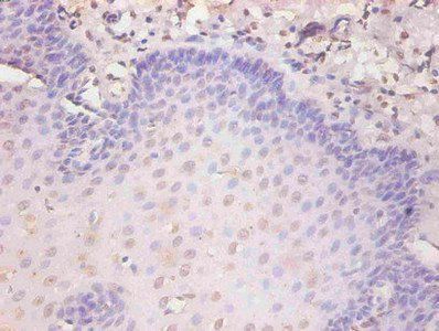 KRT19 Antibody
