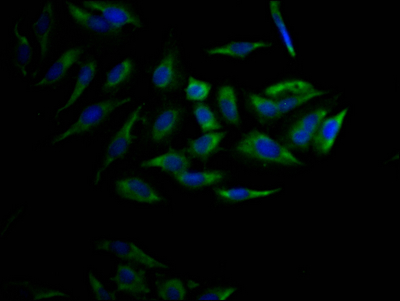 CYP17A1 Antibody
