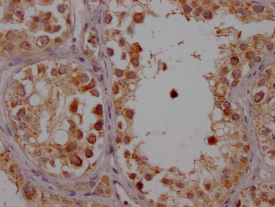 CYP17A1 Antibody