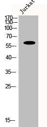 CYP1B1 Antibody