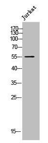 CYP21A2 Antibody
