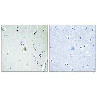 CYP2E1 Antibody