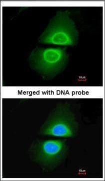 cytochrome P450 family 4 subfamily A member 11 Antibody