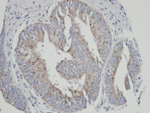 cytochrome P450 family 4 subfamily A member 11 Antibody