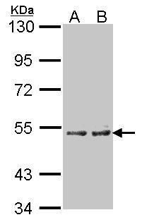 cytochrome P450 family 4 subfamily A member 11 Antibody