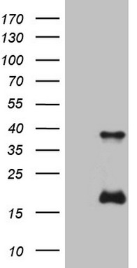 CYP7B1 Antibody