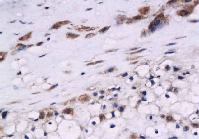 Cystatin B Rabbit Polyclonal Antibody