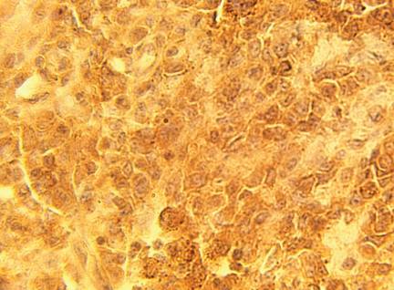 Rabbit Human Cysteine string protein (CSP) Alpha, DNAJC5 alpha Antibody