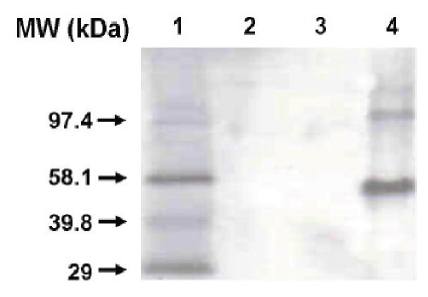 Mouse anti Human Cytochrome P450 1A2 Antibody