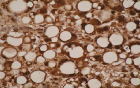 Mouse anti Human Cytochrome p450 26A1 Antibody