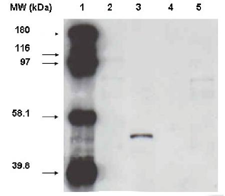 Mouse anti Human Cytochrome P450 3A7 Antibody