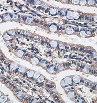 Cytochrome b Rabbit Polyclonal Antibody