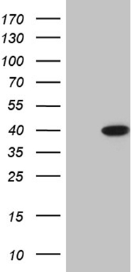 Cytokeratin 16 Antibody