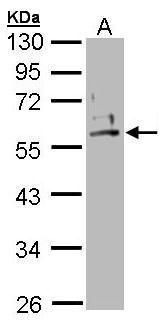 Cytokeratin 2 antibody [N2C2], Internal