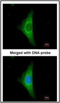 Cytokeratin 20 antibody [N2C2], Internal