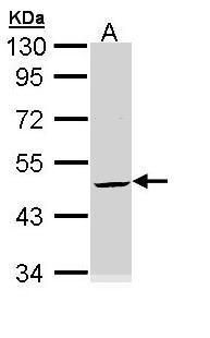 Cytokeratin 20 antibody [N2C2], Internal